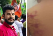 ലിവ് ഇൻ പങ്കാളിയെ മൊബൈൽ ചാർജർ ഉപയോഗിച്ച് ക്രൂരമായി മർദ്ദിച്ചു; എറണാകുളം യുവമോർച്ച ജില്ലാ സെക്രട്ടറി അറസ്റ്റിൽ: വിശദാംശങ്ങൾ വായിക്കാം