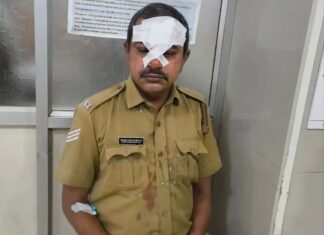 കൊല്ലങ്കോട് കാട്ടുപന്നി ആക്രമണം; എക്സൈസ് ഉദ്യോഗസ്ഥന് ഗുരുതര പരിക്ക്: വിശദമായി വായിക്കാം